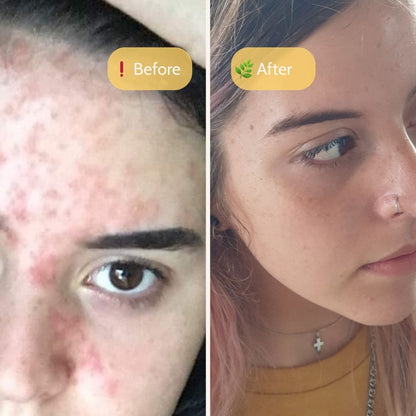 Jarrah Honey Balm - Beeautify