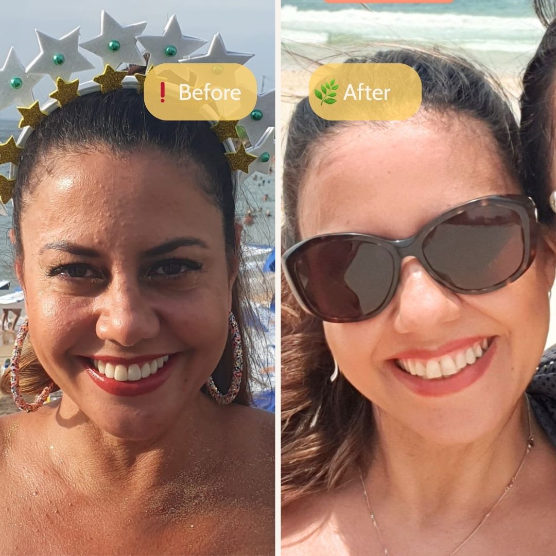 Balancing Skincare Routine - Beeautify